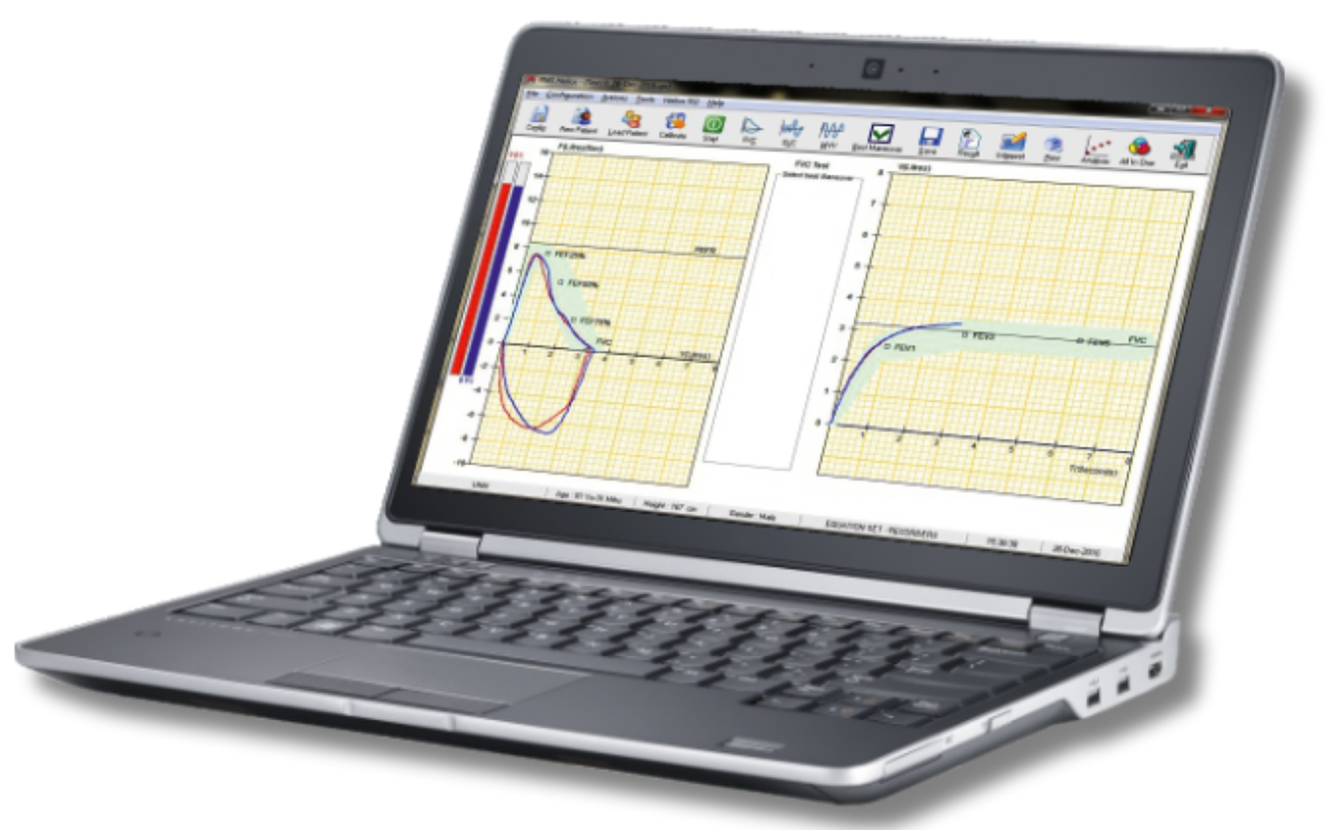 Spirometer software showing Flow-Volume and Volume-Time graphs on a laptop
